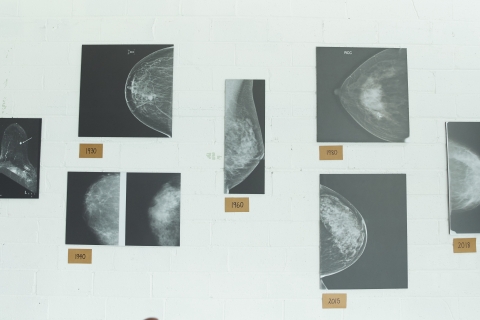 mammograms are peace of mind